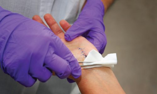 AJGP-09-2019-Focus-Sinha-Management-Post-Surgical-Wounds-Feature